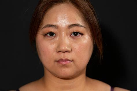 【写真多数】 美奈子が脂肪吸引手術を告白 3.5Lの脂肪を取った。